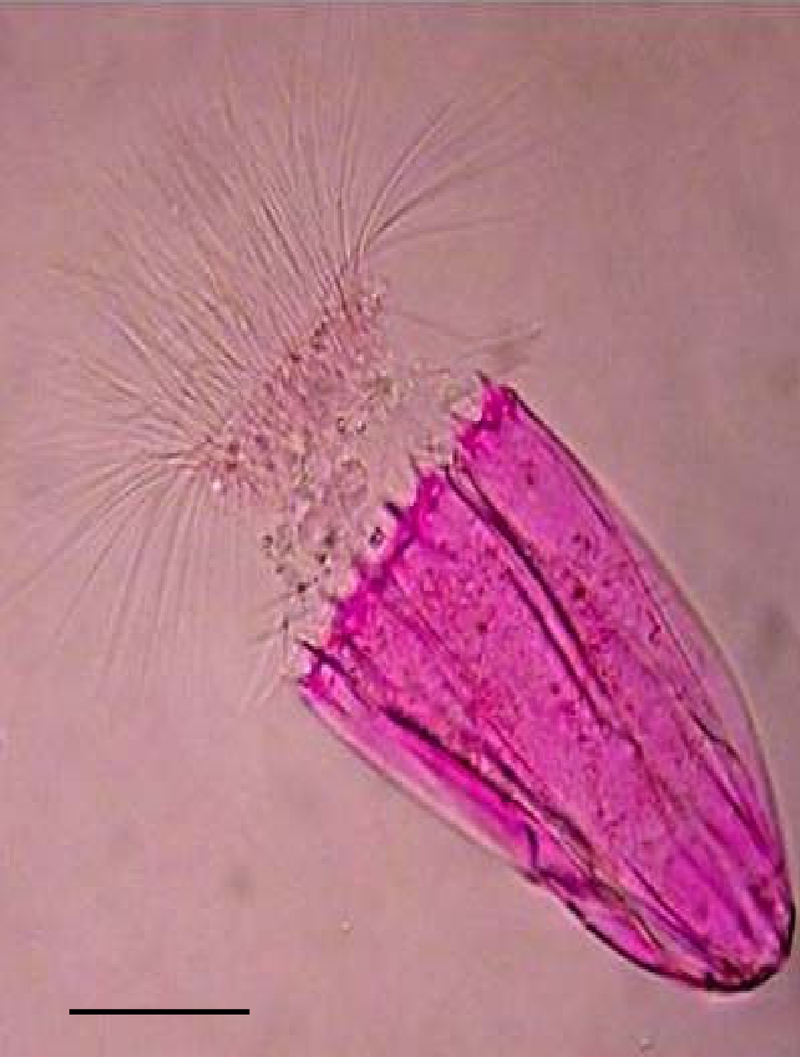 Анаэробный живой организм Spinoloricus cinziae