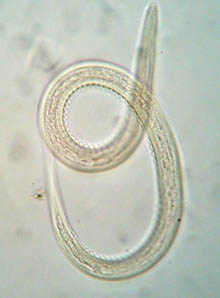 Некатор американский (Necator americanus)