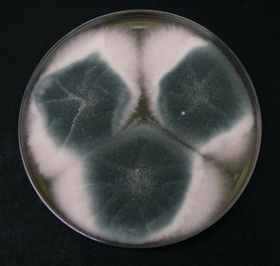 Колонии Aspergillus fumigatus
