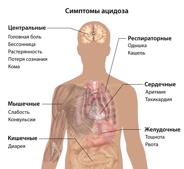 Основные симптомы ацидоза у человека