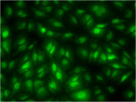 Зеленая флуоресценция двуспиральной ДНК (dsDNA), при окрашивании акридиновым оранжевым