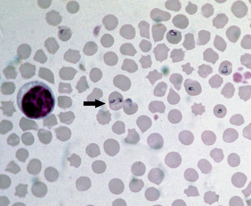 Пироплазменная стадия Babesia bovis, заражающая эритроциты коровы.