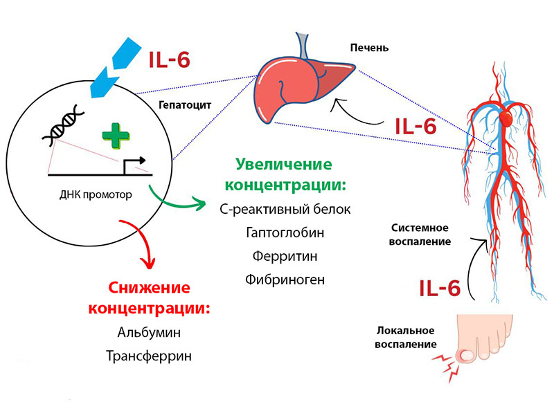Схема ответа острой фазы