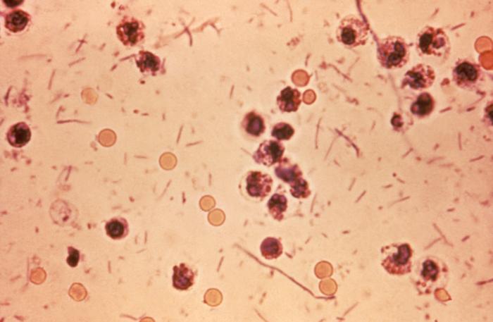 Микрофотография Shigella sp. в стуле больного бактериальной дизентерие