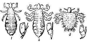 Вши и их яйца